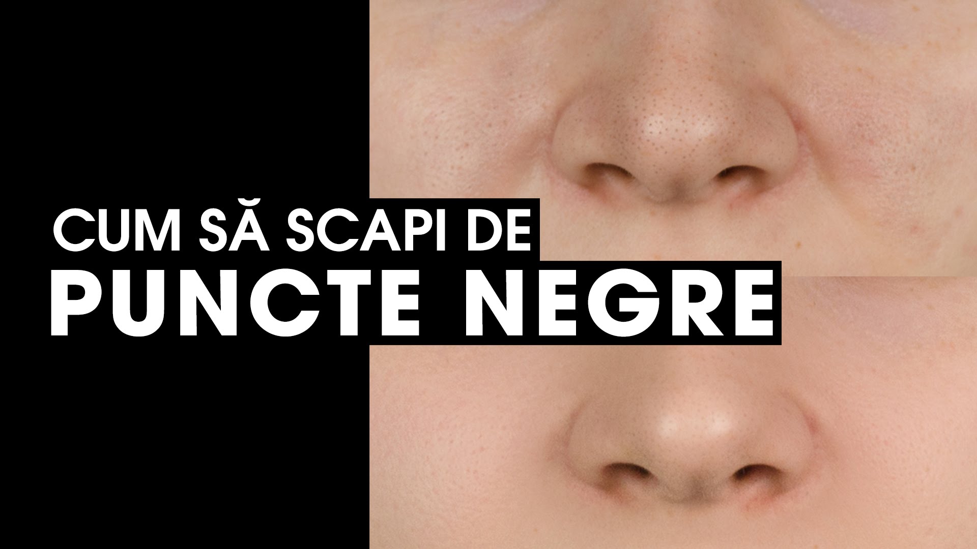 cum-sa-scapi-de-punctele-negre