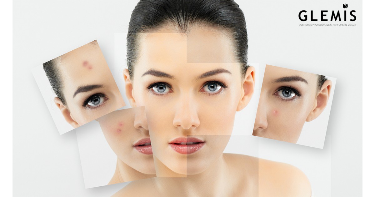 cea mai bună îngrijire anti-îmbătrânire a pielii predispusă la acnee