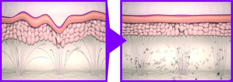 ce-nu-stiai-despre-colagen